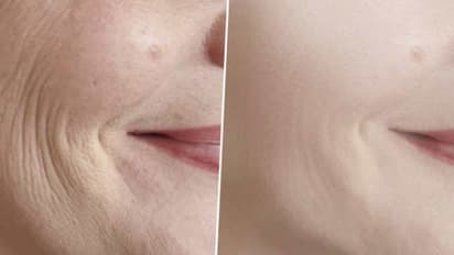 മുഖത്തെ ചുളിവുകളെ അകറ്റാന്‍ ഓട്സ് ഇങ്ങനെ ഉപയോ​ഗിക്കാം... 