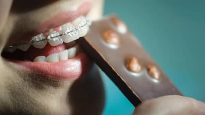 പല്ലില്‍ കമ്പിയുണ്ടോ? എങ്കില്‍, ഈ അഞ്ച് ഭക്ഷണങ്ങള്‍ കഴിക്കരുതേ...