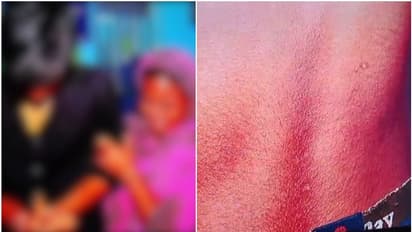 മുതുകിൽ ചവിട്ടി, ലാത്തിക്കടിച്ചു, 14 കാരനെ പൊലീസ് സ്റ്റേഷനിൽ വിളിച്ച് വരുത്തി മര്ദ്ദനം; വിചിത്ര ന്യായീകരണം