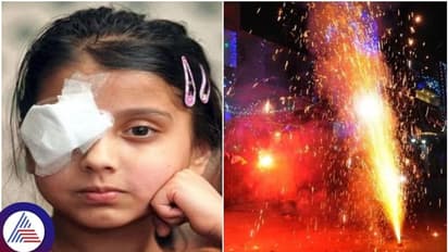 ದೀಪಾವಳಿಗೆ 24x7 ಕಣ್ಣಿನ ಚಿಕಿತ್ಸೆ, ಸಹಾಯವಾಣಿ ಆರಂಭಿಸಿದ ಮಿಂಟೋ ಆಸ್ಪತ್ರೆ: ಈಗ್ಲೇ ನೋಟ್‌ ಮಾಡ್ಕೊಳಿ!