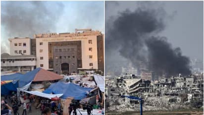 ഗാസയിൽ പരിക്കേറ്റവരെ ചികിത്സിക്കാൻ ആരോഗ്യ പ്രവർത്തകരെ ക്ഷണിച്ച് യുഎഇ; ഓൺലൈൻ രജിസ്ട്രേഷൻ ആരംഭിച്ചു