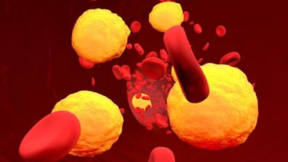 ഈ ആറ് ഭക്ഷണങ്ങള് മാത്രം കഴിച്ചാല് മതി, ചീത്ത കൊളസ്ട്രോള് കുറയ്ക്കാം...