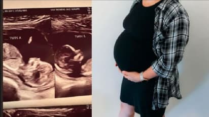 ಎರಡೆರಡು ಗರ್ಭಕೋಶ ಇರೋ ಮಹಿಳೆಗೆ ಎರಡರಲ್ಲೂ ಕುಡಿಯೊಡಿಯುತ್ತಿದೆ ಕಂದಮ್ಮ!