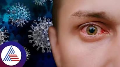 ದೇಶದ ಹೊಸ ಕೋವಿಡ್‌ ಕೇಸ್‌ಗಳಲ್ಲಿ ಕೇರಳದಲ್ಲೇ ಶೇ. 90ರಷ್ಟು ಪತ್ತೆ: ಇಲ್ಲಿ ಮಾಸ್ಕ್‌ ಕಡ್ಡಾಯ!