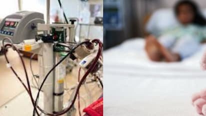 പനിയും ശ്വാസതടസവും, 10 വയസുകാരി ആശുപത്രിയിൽ; വാവറ അമ്പലം സ്വദേശിനിയെ രക്ഷിച്ചത് എസ്എടിയിലെ എക്മോ ചികിത്സ!