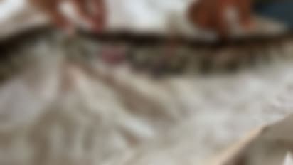 ചുറ്റും മൂന്ന് സർജൻമാർ, മൂന്ന് മണിക്കൂറോളം നീണ്ട ശസ്ത്രക്രിയ; വാഹനാപകടത്തിൽ പരിക്കേറ്റ പെരുമ്പാമ്പിന് പുതുജീവൻ