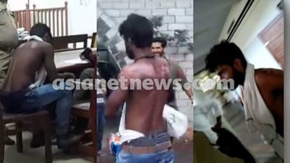 ജയിലിൽ ചൂടുവെള്ളം കൊണ്ട് പൊള്ളിച്ചെന്ന് പരാതിപ്പെട്ടത് മുഖ്യമന്ത്രിക്കെതിരെ പോസ്റ്റിട്ട് അറസ്റ്റിലായ ആൾ