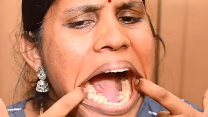 Guinness glory: Indian woman Kalpana Balan claims World Record with 38 teeth; defies dental norms