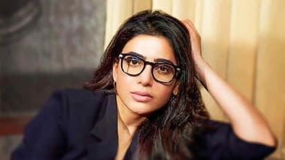 సమంతకు మరో అరుదైన వ్యాధి! అవి ముట్టుకుంటే అంతే!