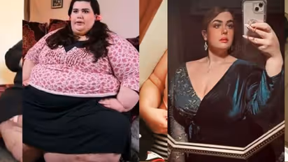 ದಢೂತಿ ದೇಹ ಹೊತ್ತು ನಡೆಯಲು ಕಷ್ಟ ಪಡ್ತಿದ್ದವಳು ಇಂದು ಸೂಪರ್ ಮಾಡೆಲ್..! 