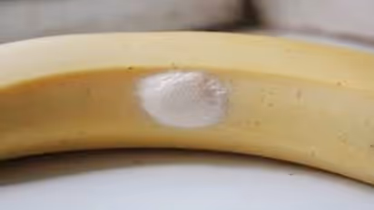 வெள்ளைப் புள்ளிகள் உள்ள வாழைப்பழத்தை சாப்பிடாதீங்க... காரணம் தெரிஞ்சா அருவருப்பா பீல் பண்ணுவீங்க!