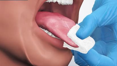 ഈ നാല് ഭക്ഷണങ്ങള് വായിലെ ക്യാന്സര് സാധ്യത കൂട്ടിയേക്കാം...