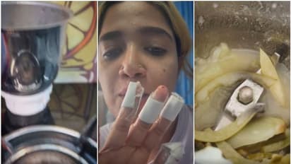 ഫുഡ് വ്ളോഗിംഗ് ചെയ്യുന്നതിനിടെ മിക്സി പൊട്ടിത്തെറിച്ചു; ഗായിക അഭിരാമിക്ക് പരിക്ക് - വീഡിയോ