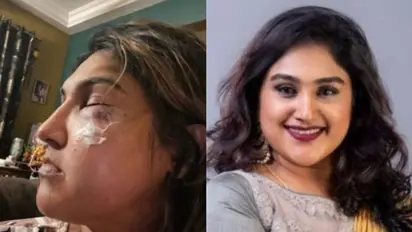 'ആക്രമണത്തില്‍ പരുക്കേറ്റു', ബിഗ് ബോസ് താരത്തിനെതിരെ നടി വനിതാ വിജയകുമാര്‍