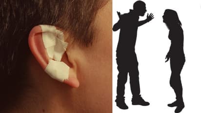 വാക്കേറ്റത്തിനിടെ തിരിഞ്ഞ് നടന്ന ഭർത്താവിന്റെ ചെവി കടിച്ചു പറിച്ച് ഭാര്യ, 45കാരന് ഗുരുതര പരിക്ക്, കേസ്