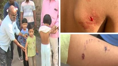 Karnataka: Vijayapura residents demand urgent action as stray dogs attack students