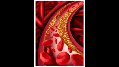 കൊളസ്ട്രോൾ നിയന്ത്രിക്കാൻ കഴിക്കാം ഈ സൂപ്പർ ഫുഡുകൾ 