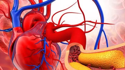 ഈ സുഗന്ധവ്യഞ്ജനം മോശം കൊളസ്ട്രോൾ കുറയ്ക്കാൻ സഹായിക്കും