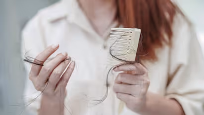 പതിവായി ഈ പത്ത് ഭക്ഷണങ്ങള്‍ കഴിക്കൂ, തലമുടി തഴച്ചു വളരും...