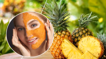 പൈനാപ്പിൾ മുഖത്ത് ഇങ്ങനെ പുരട്ടൂ; അറിയാം ഈ അത്ഭുത ഗുണങ്ങള്...