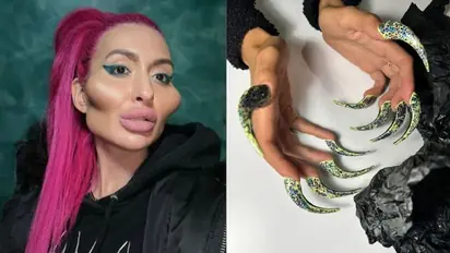 Woman with 'world's largest cheeks' unveils 'witch-like' nail transformation; draws mixed reactions (WATCH)