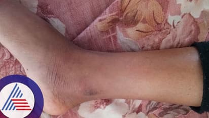 ತುಮಕೂರು: ಹಾವು ಕಚ್ಚಿದ್ದು ಗೊತ್ತಾಗದೇ ವೈದ್ಯ ವಿದ್ಯಾರ್ಥಿ ಸಾವು!