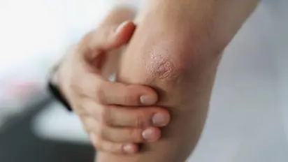 നിങ്ങളില് സിങ്കിന്റെ കുറവുണ്ടോ? ശരീരം കാണിക്കും ഈ ലക്ഷണങ്ങള്...