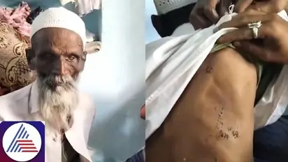 Viral Video: Visually-impaired man in Karnataka brutally attacked; forced to chant 'Jai Shri Ram', beard burnt