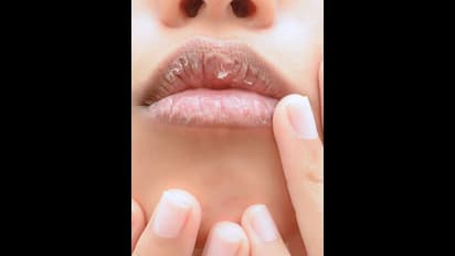 అసలు పెదవులు ఎందుకు పగులుతాయో తెలుసా?