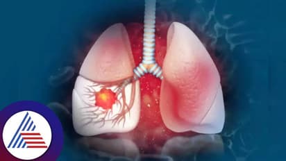 ಮಕ್ಕಳನ್ನು ಕಾಡ್ತಿದೆ ಅಪಾಯಕಾರಿ ಶ್ವಾಸಕೋಶ ರೋಗ, ಏನಿದು ವೈಟ್ ಲಂಗ್ ಸಿಂಡ್ರೋಮ್?