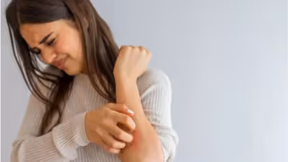 ഈ അഞ്ച് വിറ്റാമിനുകളുടെ കുറവ് ചര്മ്മം വരണ്ടതാക്കും...