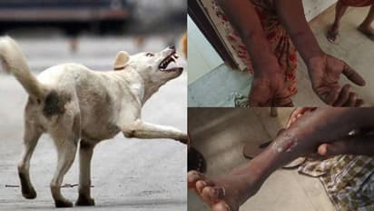 തെരുവു നായ് ആക്രണം, നാലുപേര്‍ക്ക് കടിയേറ്റു, പേപ്പട്ടിയെന്ന് നാട്ടുകാര്‍