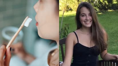 തൊണ്ടയിൽ കുടുങ്ങിയ ഇറച്ചി നീക്കാനായി 21കാരി ഉപയോഗിച്ചത് ബ്രഷ്, മരണത്തെ മുന്നിൽ കണ്ട് മണിക്കൂറുകൾ...