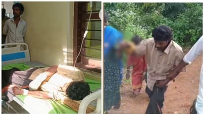 കരടിയുടെ ആക്രമണത്തിൽ യുവാവിന്റെ കൈക്കും കാലിനും പരിക്ക്