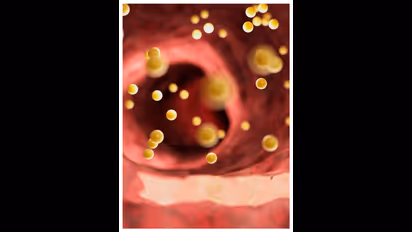 ഈ ചേരുവ മതി, ചീത്ത കൊളസ്ട്രോൾ ഈസിയായി കുറയ്ക്കാം 