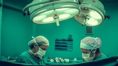 Bengaluru medical team removes live larva infesting 26-year-old woman's scalp