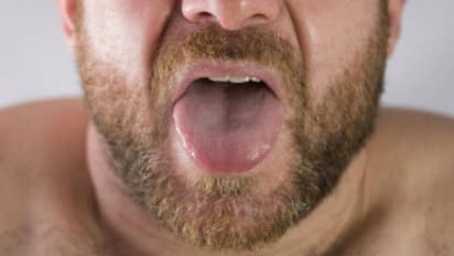 നാവിലെ നിറം മാറ്റത്തിലൂടെ അസുഖങ്ങളും ആരോഗ്യപ്രശ്നങ്ങളും മനസിലാക്കാം...