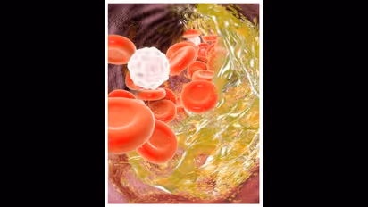 മരുന്നുകളില്ലാതെ കൊളസ്ട്രോൾ കുറയ്ക്കാം ; ഈ മൂന്ന് ഭക്ഷണങ്ങൾ ഡയറ്റിൽ ഉൾപ്പെടുത്തൂ