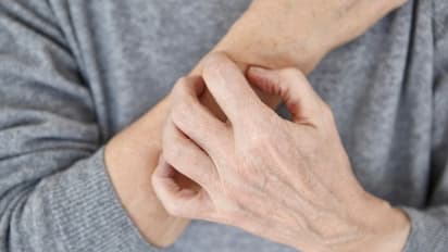 വരണ്ട ചർമ്മത്തോട് വിട പറയാം ; ഈ പോഷകങ്ങൾ അടങ്ങിയ ഭക്ഷണങ്ങൾ ഡയറ്റിൽ ഉൾപ്പെടുത്തൂ