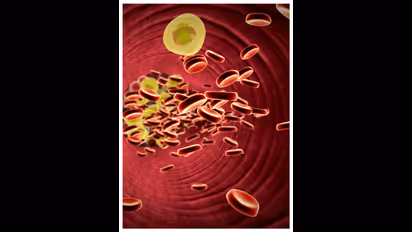 Health Tips :  കൊളസ്ട്രോൾ നിയന്ത്രിക്കാൻ കഴിക്കാം ഈ പഴങ്ങൾ 