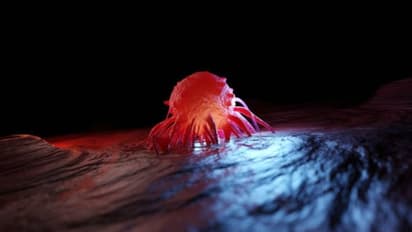 സര്ജറിയില്ലാതെ ഫലപ്രദമായി അതിവേഗം ക്യാൻസര് നശിപ്പിക്കും!; പുതിയ കണ്ടെത്തലുമായി ഗവേഷകര്