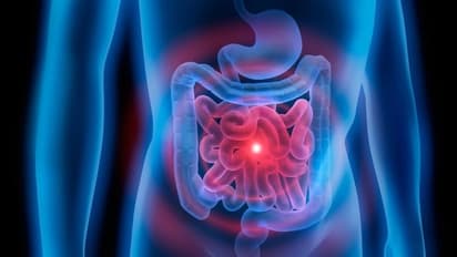 അമിതവണ്ണം കുറയ്ക്കാൻ ഗുളിക!; അത്യുഗ്രൻ കണ്ടുപിടുത്തവുമായി ഗവേഷകര്