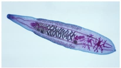 70 കാരന് കഠിനമായ വയറുവേദന, പരിശോധനയില് കണ്ടത് ട്യൂമര്; ശസ്ത്രക്രിയയിലൂടെ നീക്കം ചെയ്തത് 5 വിരകളെ !