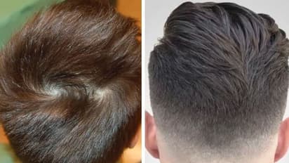 ತಲೆಯಲ್ಲಿ ಎರಡು ಸುಳಿಯಿದ್ದರೆ ಎರಡು ಮದುವೆಯಾಗುತ್ತೆ ಅನ್ನೋದು ನಿಜಾನ?