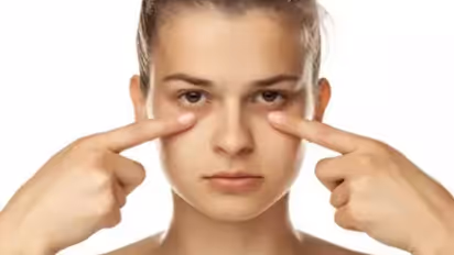 കണ്ണിന് ചുറ്റുമുള്ള കറുപ്പ് മാറാൻ പരീക്ഷിക്കാം ഈ പൊടിക്കെെകൾ