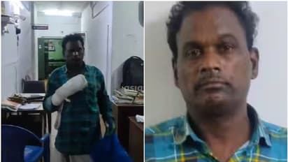 സംശയം, ആക്സിഡന്‍റ് ക്ലെയിം ഒപ്പിടാത്തതിൽ ദേഷ്യം; ഭാര്യയുടെ മുഖത്ത് ആസിഡൊഴിച്ച് കൊല്ലാൻ ഭർത്താവിന്‍റെ ശ്രമം 