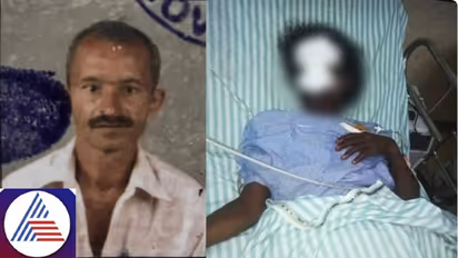 Barbaric act: Belagavi anganwadi teacher's nose chopped off over allegation of children picking flowers