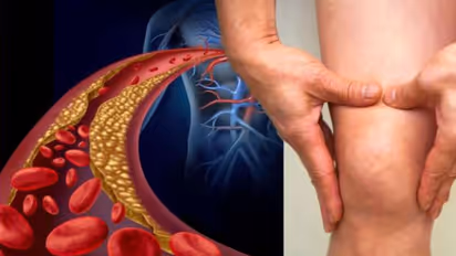 ఒంట్లో కొవ్వు పెరిగిపోయిందా..? ఈ లక్షణాలు కనిపిస్తాయి..!