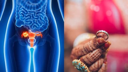 ഭാര്യക്ക് ക്യാൻസർ, ഗർഭപാത്രം നീക്കി, വിവാഹമോചനം ആവശ്യപ്പെട്ട് യുവാവ്, തള്ളി കോടതി, ബന്ധുക്കൾക്ക് രൂക്ഷ വിമർശനം