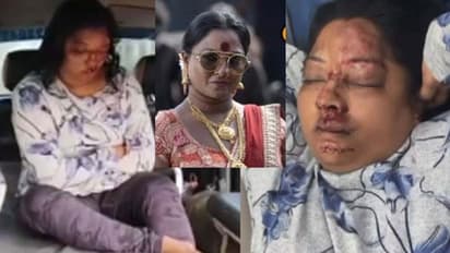 ముఖం నిండా గాయాలతో సలార్ నటి,  దొరసానికి ఏమయ్యింది..? 